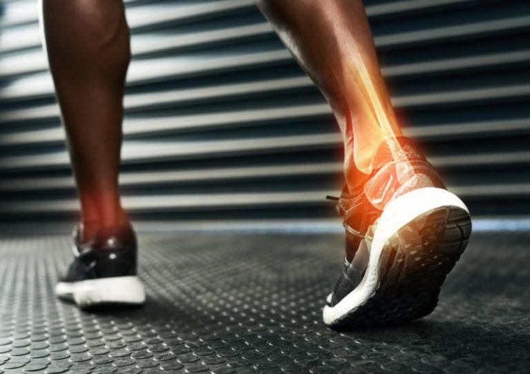 Tendinites / Tendinopathies